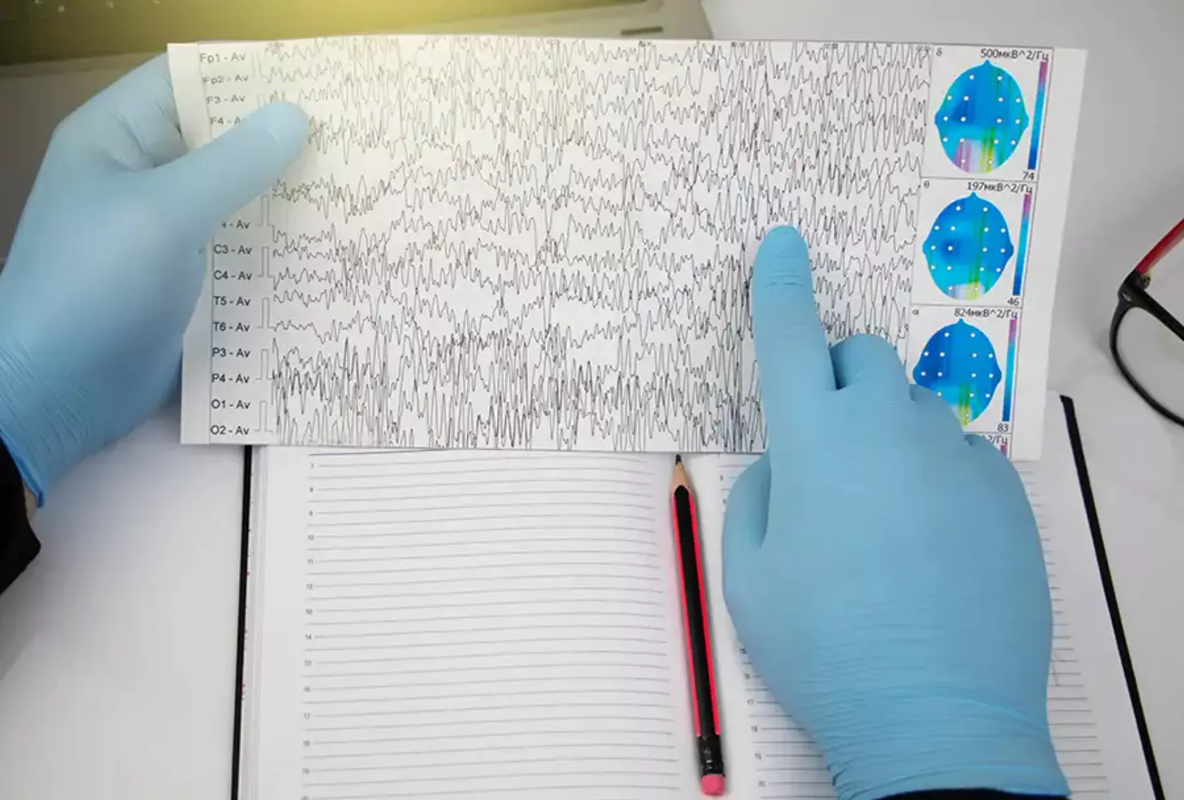 EEG-Kurve in den Händen eines Mediziners.
