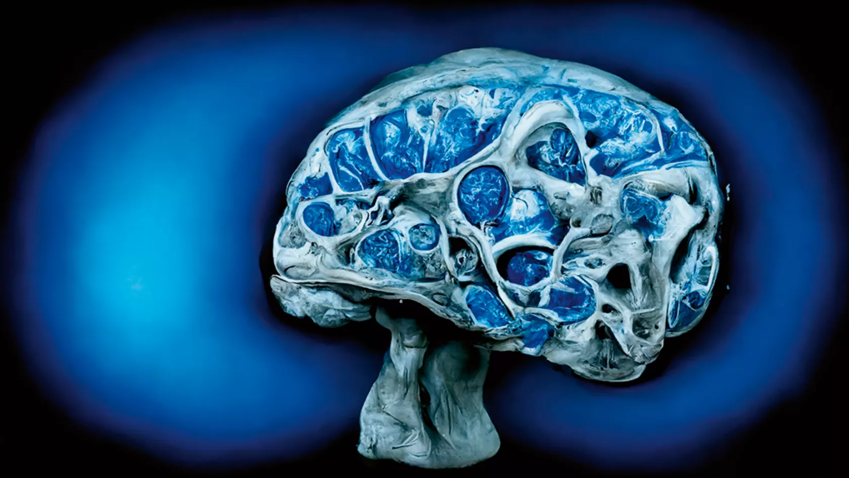 Blaue KI-Darstellung des Gehirns in 3D mit Neuroinflammation.