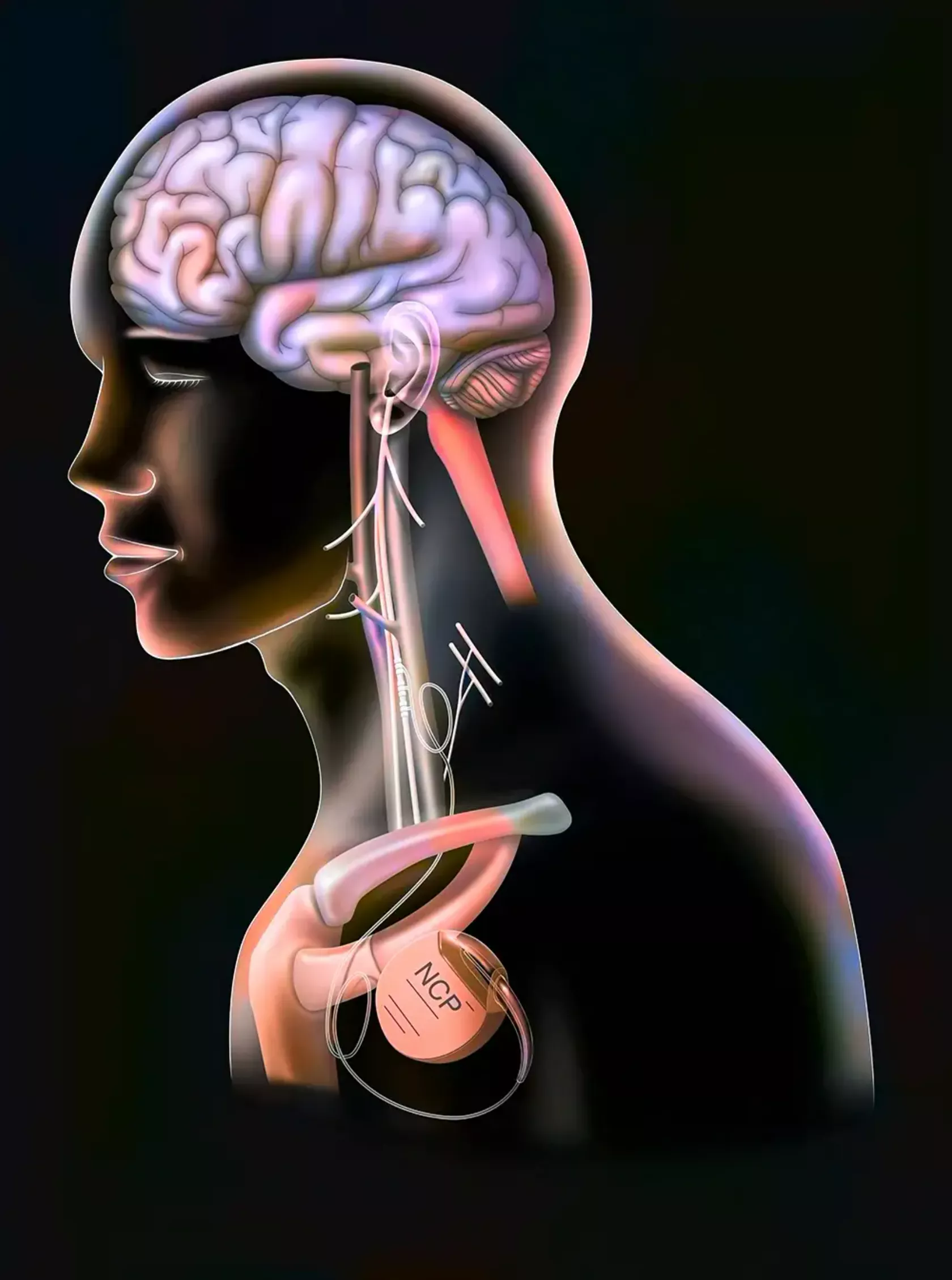 KI-Darstellung eines Menschen im Querschnitt mit Fokus auf Gehirn und Nervenbahnen.