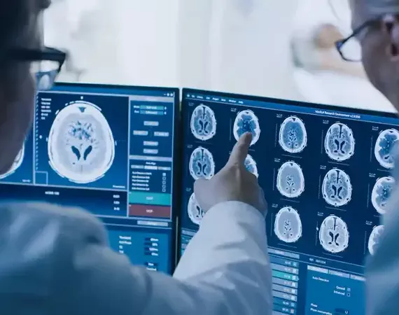 Ärzte diskutieren am Bildschirm ein Gehirn-MRT.