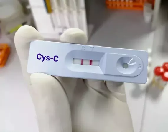 Testkassette mit der Aufschrift Cys-C - beide Streifen bei C und T sind sichtbar.
